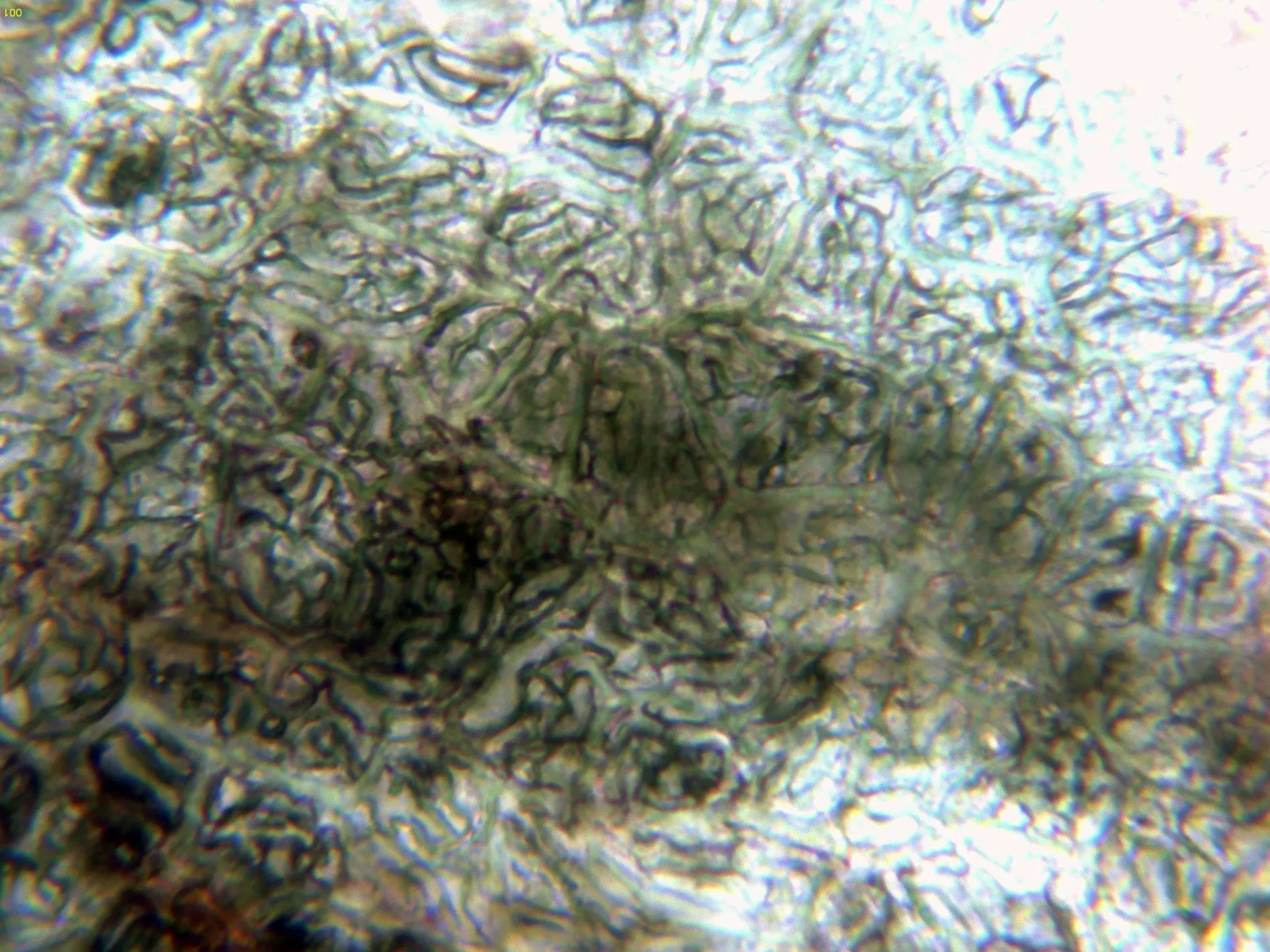 Microscopía de Phomopsis glandicola - 13 - Pared peritecio-001
